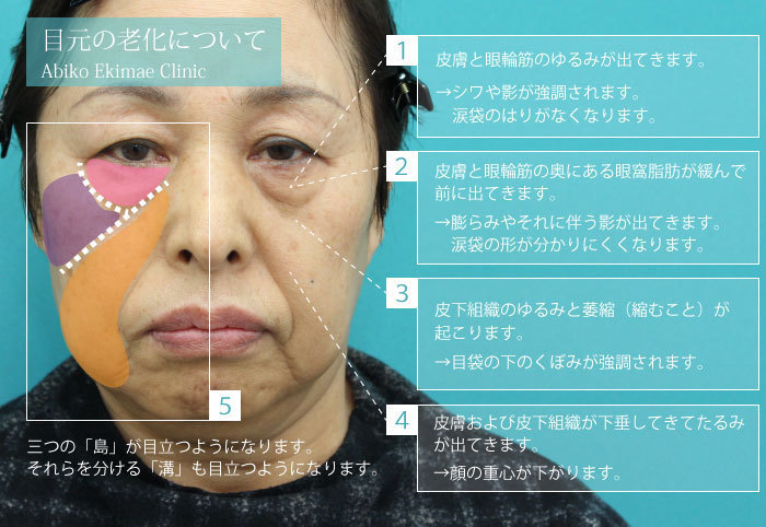 眼 輪 筋 の 筋 トレ 眼 輪 筋 の 筋 トレ