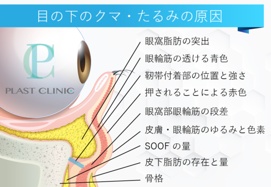 目の下 の クマ を 治す 方法 だっ し プラスト クリニック